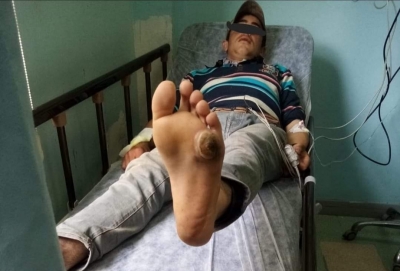 idil'de Elektrik akımına kapılan 13 Yaşındaki çocuk ağır yaralandı