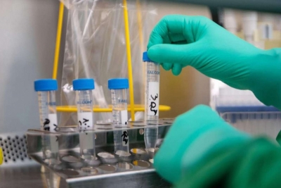 Koronavirüs 65 can daha aldı